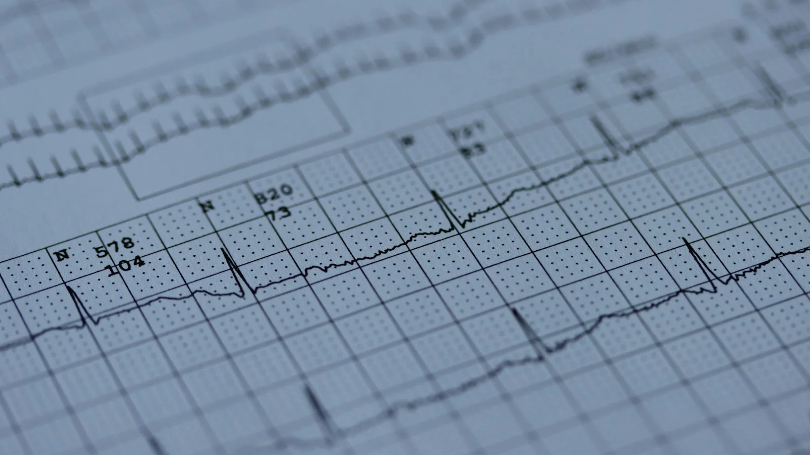 Holter 24 Horas: Para que Serve e Como é o Exame